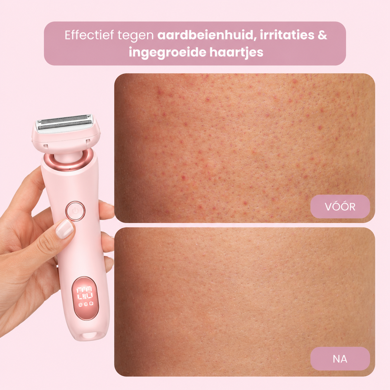 Neolys Pro™ Vroeg Zomer Starterspakket