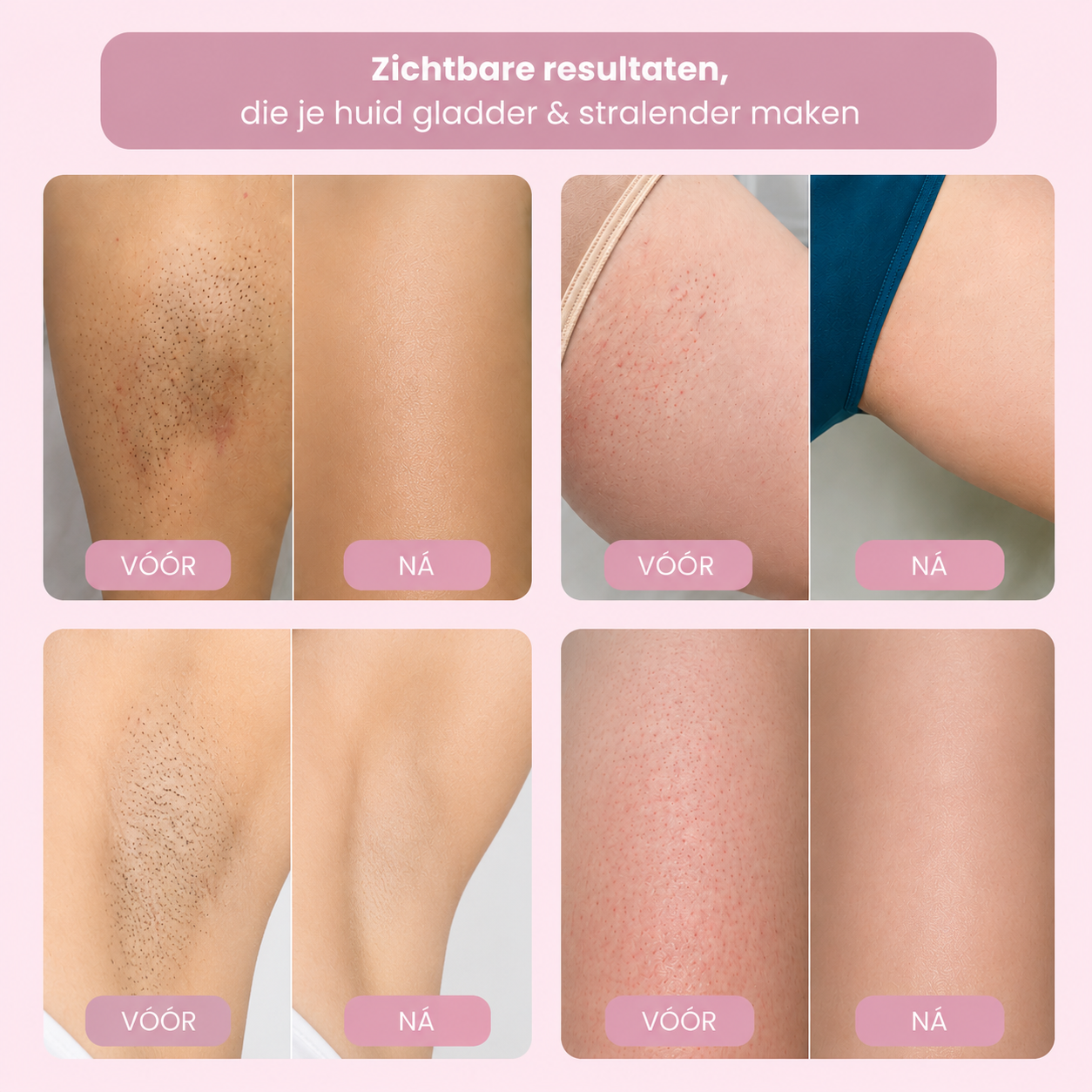 Neolys Pro™ Vroeg Zomer Starterspakket
