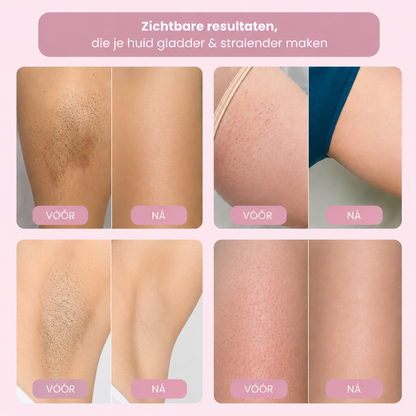 Neolys Pro™ Vroeg Zomer Starterspakket